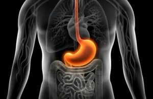 Gastrite, inflammation de la paroi de l'estomac 