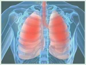 Maladie pulmonaire, affection d'une ou des différentes parties du poumon, bronches, parenchyme, ou plèvre