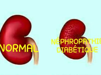 Néphropathie