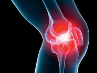 Arthrose