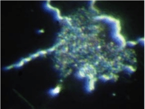 La serrapeptase : efficace contre la maladie de Lyme ? maladie de lyme biofilm