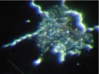 maladie de lyme biofilm