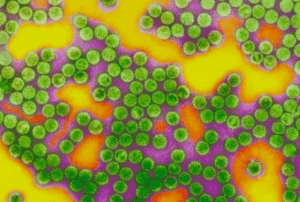 Condylome, verrue génitale et anale