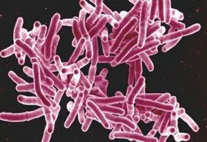 Tuberculose, infection bactérienne due à la présence de bacille de Koch