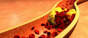 butyrate et cholestérol