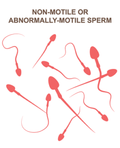 Traitements naturels de l’asthénozoospermie asthénozoospermie