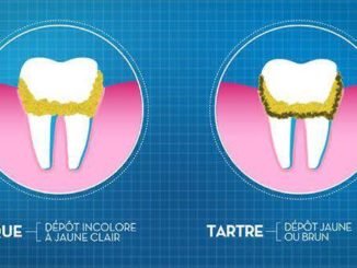 tartre